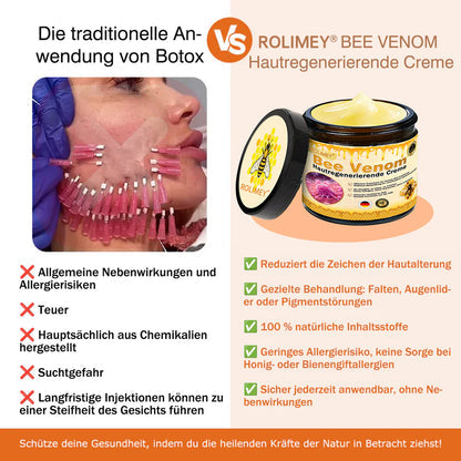 🔥Rolimey® Bienengift Pro Umfassende Creme — 🔥Begrenzte Zeit 80 % RABATT🔥